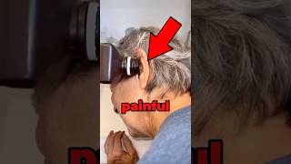 Bug Found Inside Ear 😱 [upl. by Chew]