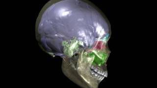 Human skull with brain endocast paranasal sinuses amp mastoid sinuses [upl. by Ahseiuqal]