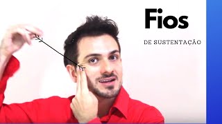 Fios de Sustentação  Harmonização Facial I Dr Diogo Branco [upl. by Neumark538]