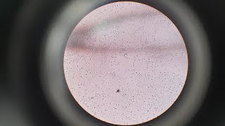 Semen Analysis Test  Microscopic Examination of Semen Test  Semen Test Procedure [upl. by Ahsayn]