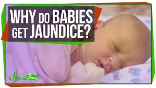 Why Do Newborn Babies Get Jaundice [upl. by Chasse782]