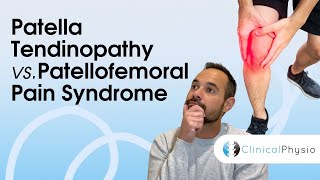 Patella Tendinopathy vs Patellofemoral Pain Syndrome  Expert Physio Guide [upl. by Panaggio]