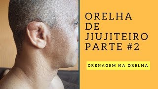 Orelha de Jiujiteiro Parte 2 [upl. by Suruat2]