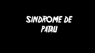 Síndrome de patau [upl. by Orsola155]