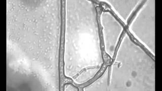 Anastomosis in mycorrhizal fungi [upl. by Nevin]