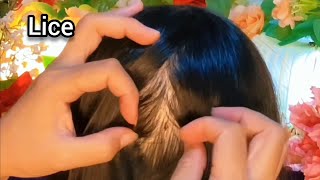 ASMR Satisfying I will help remove your fleas  No Talking 😴💤🥱 [upl. by Sonafets]