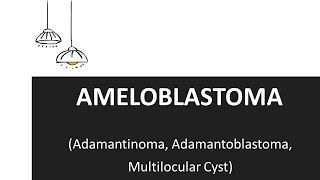 Ameloblastoma  Clinical Features and Treatment of Ameloblastoma [upl. by Lithea]