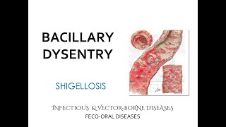 FecoOral diseases Bacillary Dysentery Shigellosis Lecture [upl. by Matthew208]