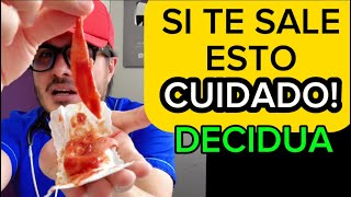 Endometriosis síntomas y tratamiento  Reacción Decidual Endometrial [upl. by Katusha]