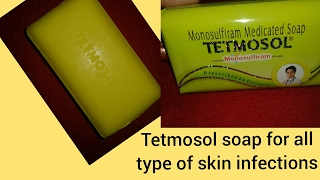 TETMOSOL Soap for skin infection Medicated soap Best soap for sensitive skin My experience [upl. by Ardnat]