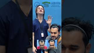 FASTEST Way to Regain Your Confidence with iPlus™️ FUE Hair Transplant Expert  Happy Patient Review [upl. by Othella]