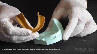 Preclinical Prosthodontics Mandibular shellac Base plate adaptation [upl. by Greg476]