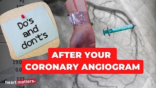 Post your coronary angiogram  What to know [upl. by Mora]