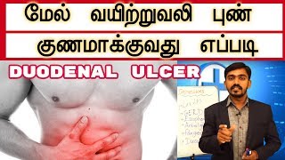 மேல் வயிற்றுவலி அல்லது முன்சிறுகுடல் புண் குணமாக்குவது எப்படி l Duodenal ulcer Cure Drsj [upl. by Yolanthe]