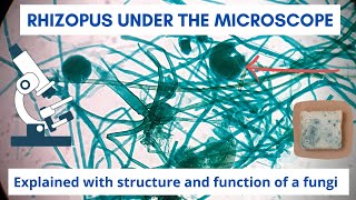 Rhizopus Nigricans Bread mold under the microscope  Fungi structure and function [upl. by Nauqahs716]