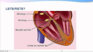 Introductiecursus ECG interpretatie [upl. by Nuahsel859]