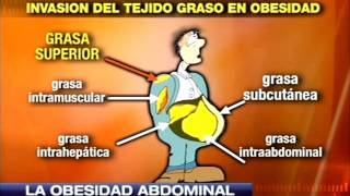 Dr Cormillot  Obesidad tipos y complicaciones [upl. by Euv]