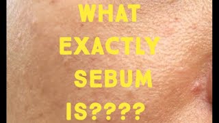 What is sebum How it cause acne [upl. by Elesig]