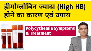 High hemoglobin Polycythemia Causes Symptoms Investigation and Treatment in Hindi [upl. by Winfrid713]