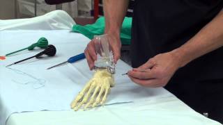 Dr Moore Explains Ankle Ligament Repair and Reinforcement Using the Arthrex Internal Brace [upl. by Neztnaj]