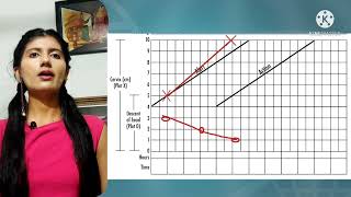 partograph explained [upl. by Mersey40]