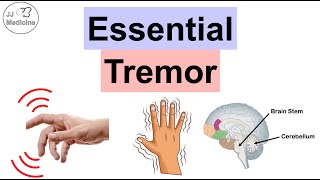 Essential Tremor  Causes Pathophysiology Symptoms Exacerbating Factors Diagnosis Treatment [upl. by Atis436]