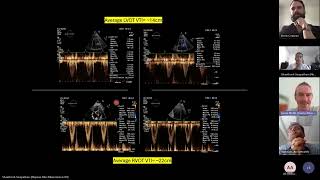 Cases for post MI complication talk [upl. by Anerroc]