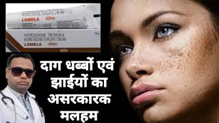 Ointment for melasma। Lomela ointment review Hydroquinone Tretinoin amp Mometasone cream। uses। [upl. by O'Grady]