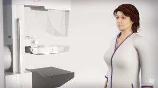 Mammogram for Breast Cancer  What to Expect [upl. by Rehpotsihc]