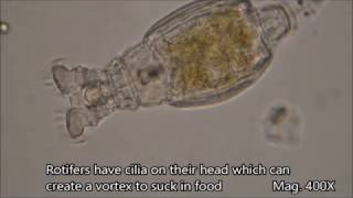 Rotifers under the microscope [upl. by Adnyleb]