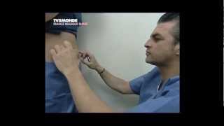 Lipolyse de labdomen par le Docteur Thierry LAFITTE TV5 Mondemp4 [upl. by Ahseem]