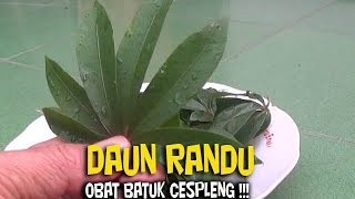 BATUK ANDA TAK MAU REDAINI OBATNYA [upl. by Weigle]