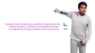 013 Subclavius muscle stretching exercise [upl. by Docilu]