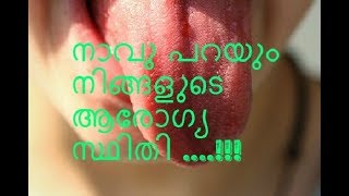 നാവ് പറയും നിങ്ങളുടെ ആരോഗ്യംNavile punnu navu vedana maran  tongue pain [upl. by Llien]