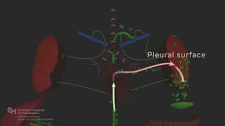 Chylothorax [upl. by Rubio606]