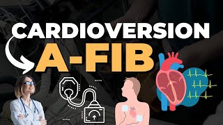 Cardioversion Procedure Steps and Video  E Healthy Info cardioversion [upl. by Enelia]