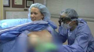 Mommy Makeover under local anesthesia by cosmetic surgeon Dr Walter W Tom [upl. by Gracia]