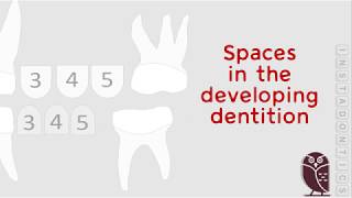 Developmental spaces in the Dental arch [upl. by Refiffej998]