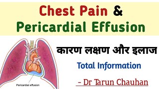 Pericardial Effusion in hindi  chest pain and pericardial effusion  seene me dard [upl. by Evelc]