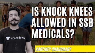 Knock Knee  Easy Treatment with Exercise for Indian Armed Forces  Kartikey Chaudhary [upl. by Isbella]