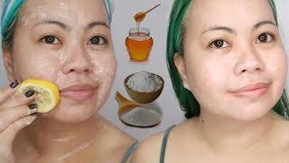 Whiten SKIN with BAKING SODA fight acne hyperpigmentation amp get fair skin [upl. by Aihsele314]