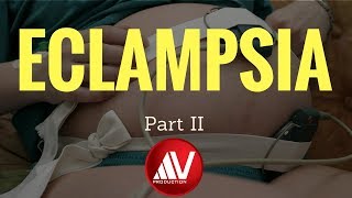 Eclampsia Part II [upl. by Jaal]