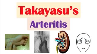 Takayasu’s Arteritis Pulseless Disease  Large Vessel Vasculitis Symptoms Diagnosis Treatment [upl. by Imoyaba]