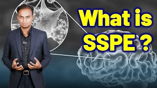 What is SSPE or Subacute Sclerosing Panencephalitis or Dowson Disease  Homeopathy Treatment amp Cure [upl. by Uttasta]