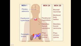 Endocrinology Review Questions  CRASH Medical Review Series [upl. by Bertolde913]