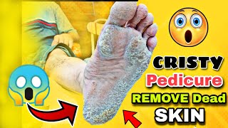 Perfect Pedicure at Home Nail Care Tips and Tricksquot [upl. by Yderf]