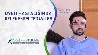 Üveit Hastalığında quotGeleneksel Tedaviler quot [upl. by Newby253]