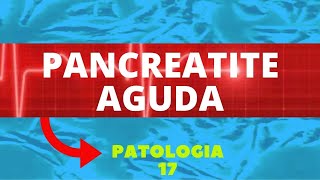 PANCREATITE AGUDA  CARACTERÍSTICAS DIAGNÓSTICO E TRATAMENTO [upl. by Jillie]