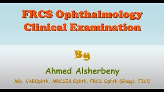 Clinical Ocular Examination  Part 2 Pupil Examination Part 2 amp Confrontation Test [upl. by Cod726]