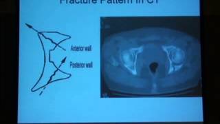 12 Radiological diagnosis of the acetabulum H Abdel Azeem [upl. by Ahtnicaj19]